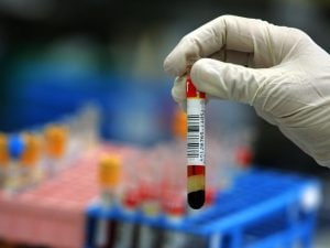 test-del-sangue-cancro-300x225.jpg