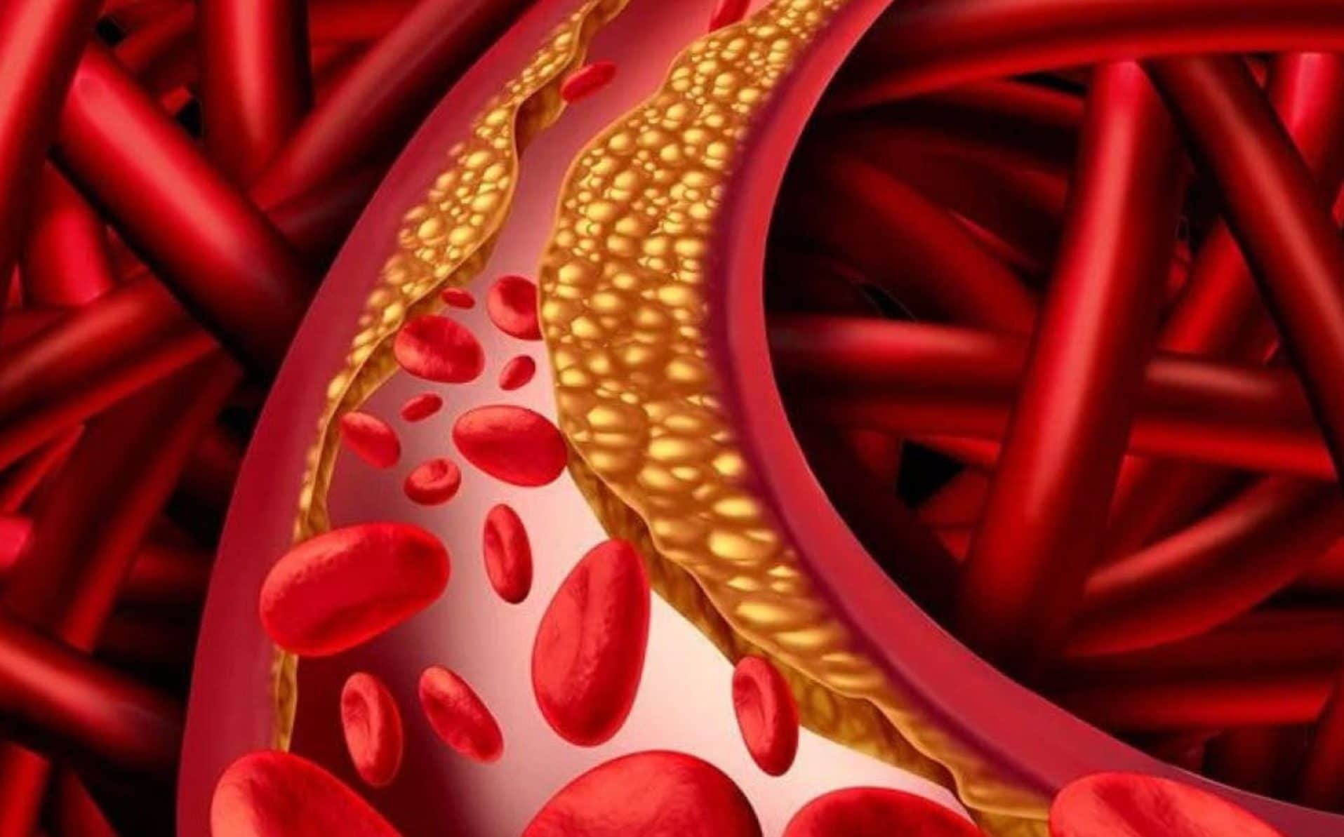 La pillola che riduce del 60% il colesterolo cattivo: come funziona il farmaco enlicitide in fase di studio