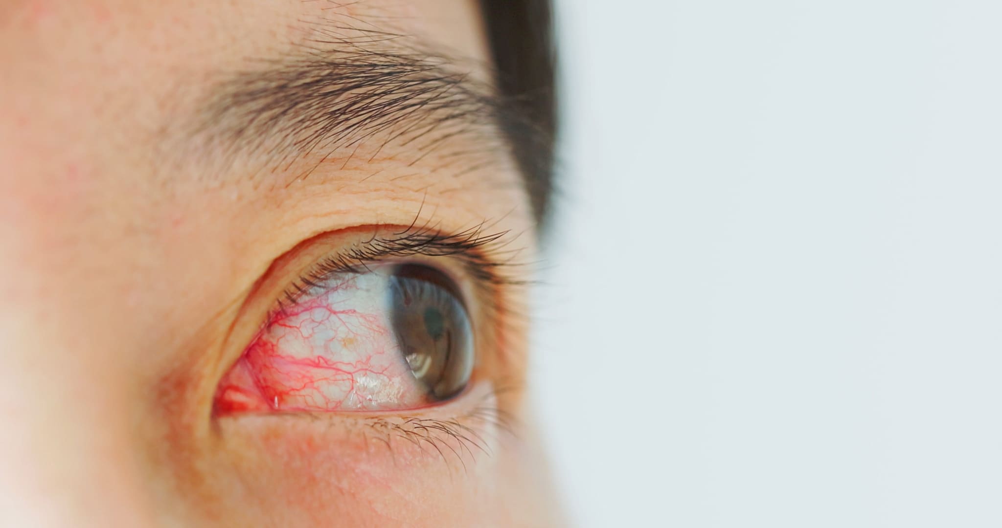 L’occhio umano è irrorato di vasi sanguigni