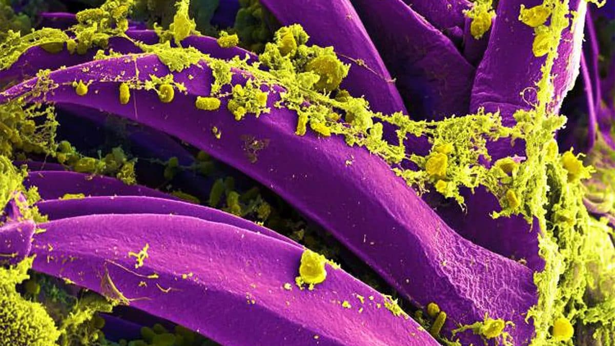 Yersinia pestis (in giallo), il batterio che causa la peste. Immagine al microscopio elettronica a scansione colorata digitalmente / Credit: NIAID/CDC