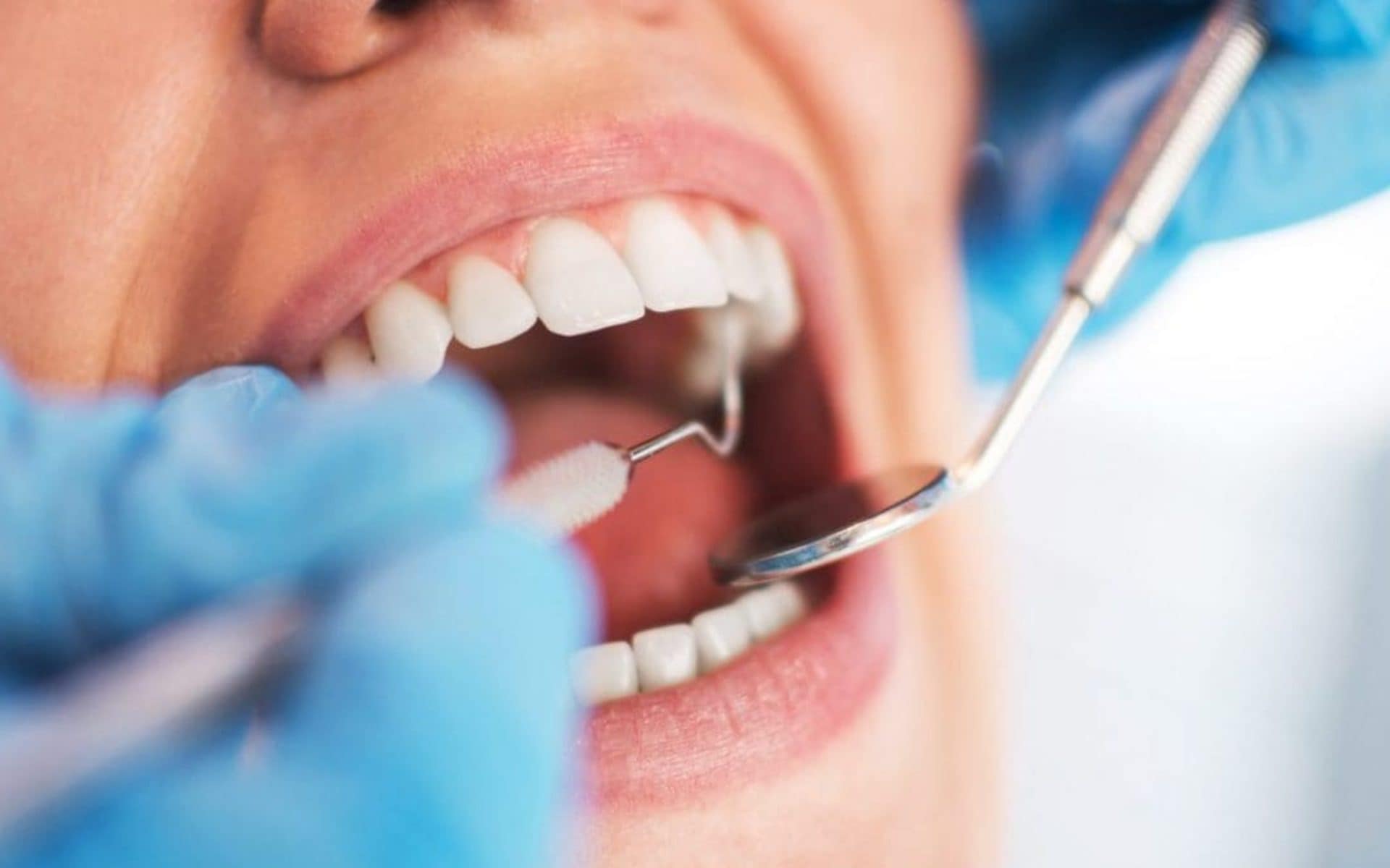 C'è un legame tra gengive e rischio di malattie cardiache, gli esperti: "Cuore e bocca sono collegati"