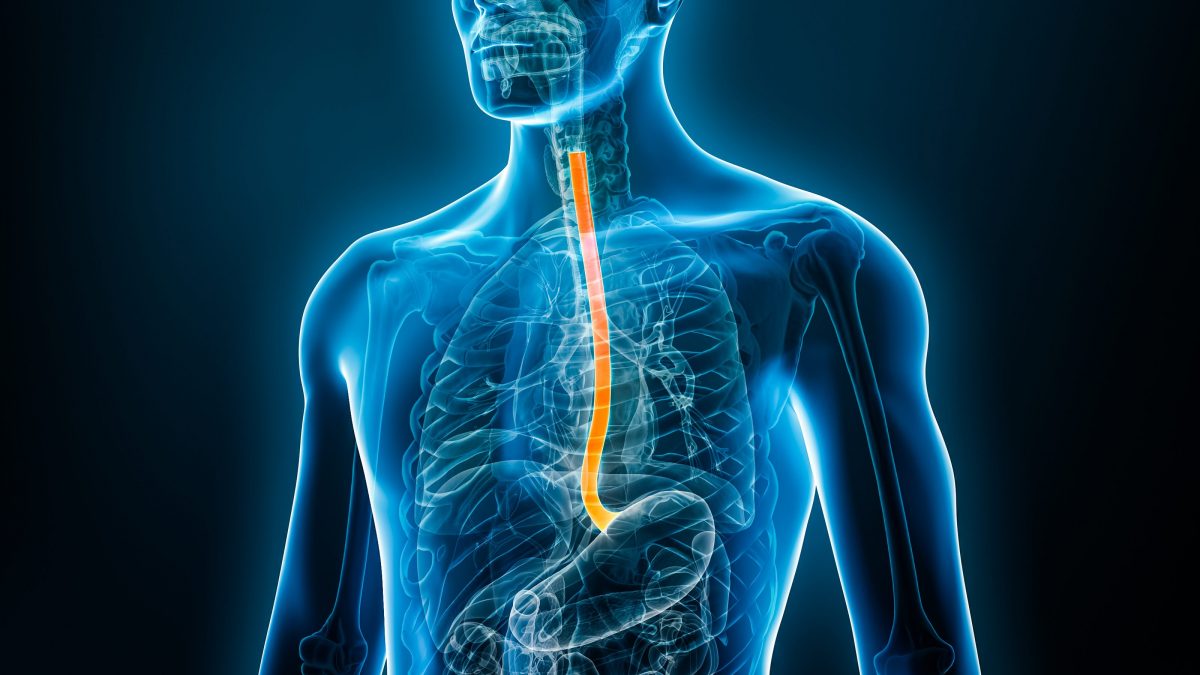 Illustrazione medica dell’esofago umano, l’organo al centro della spiegazione sulla perforazione esofagea che in casi rari può verificarsi dopo violenti conati di vomito / Credit: iStock
