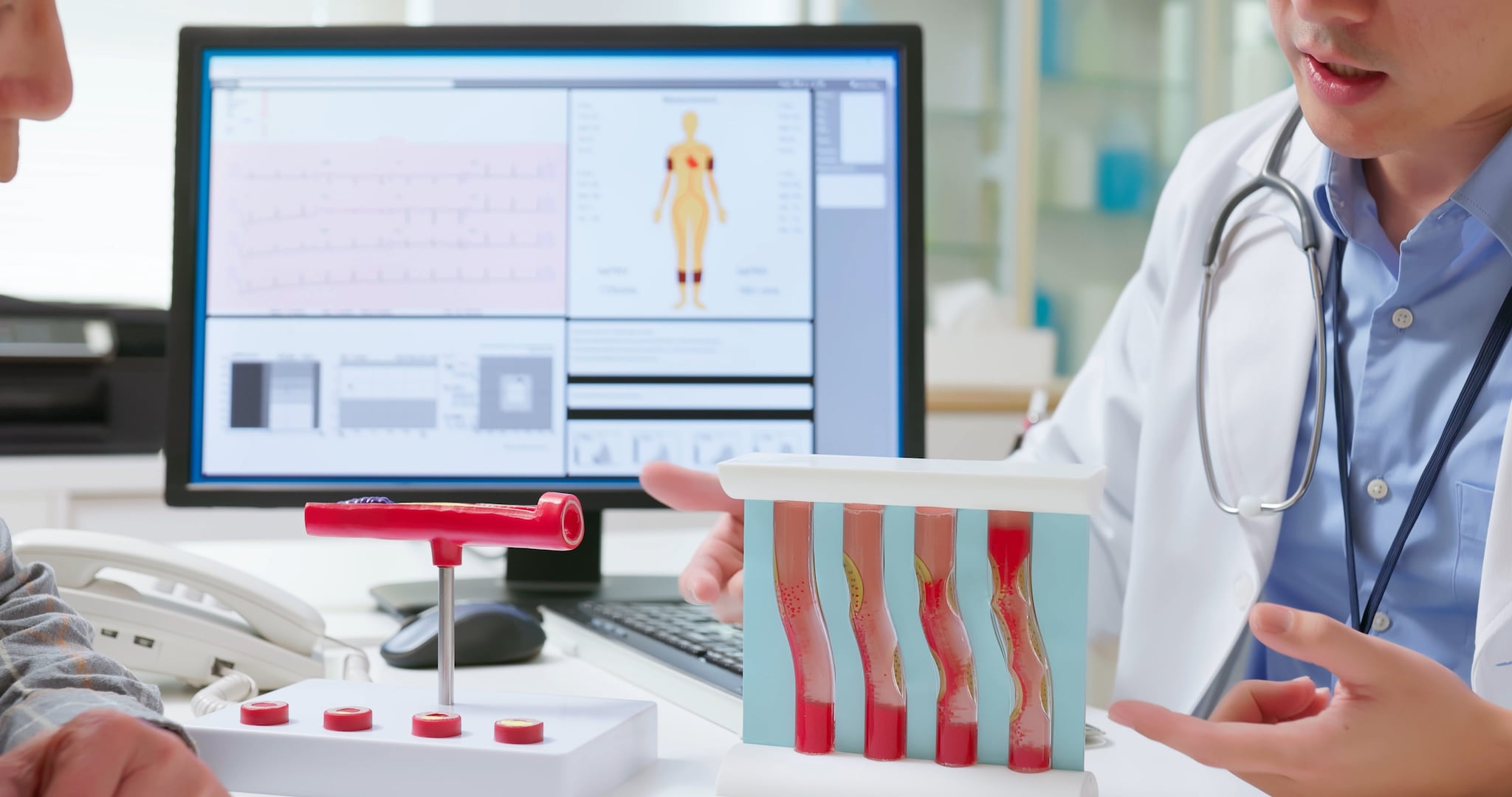 Perché le statine causano dolori muscolari? La spiegazione arriva da un nuovo studio