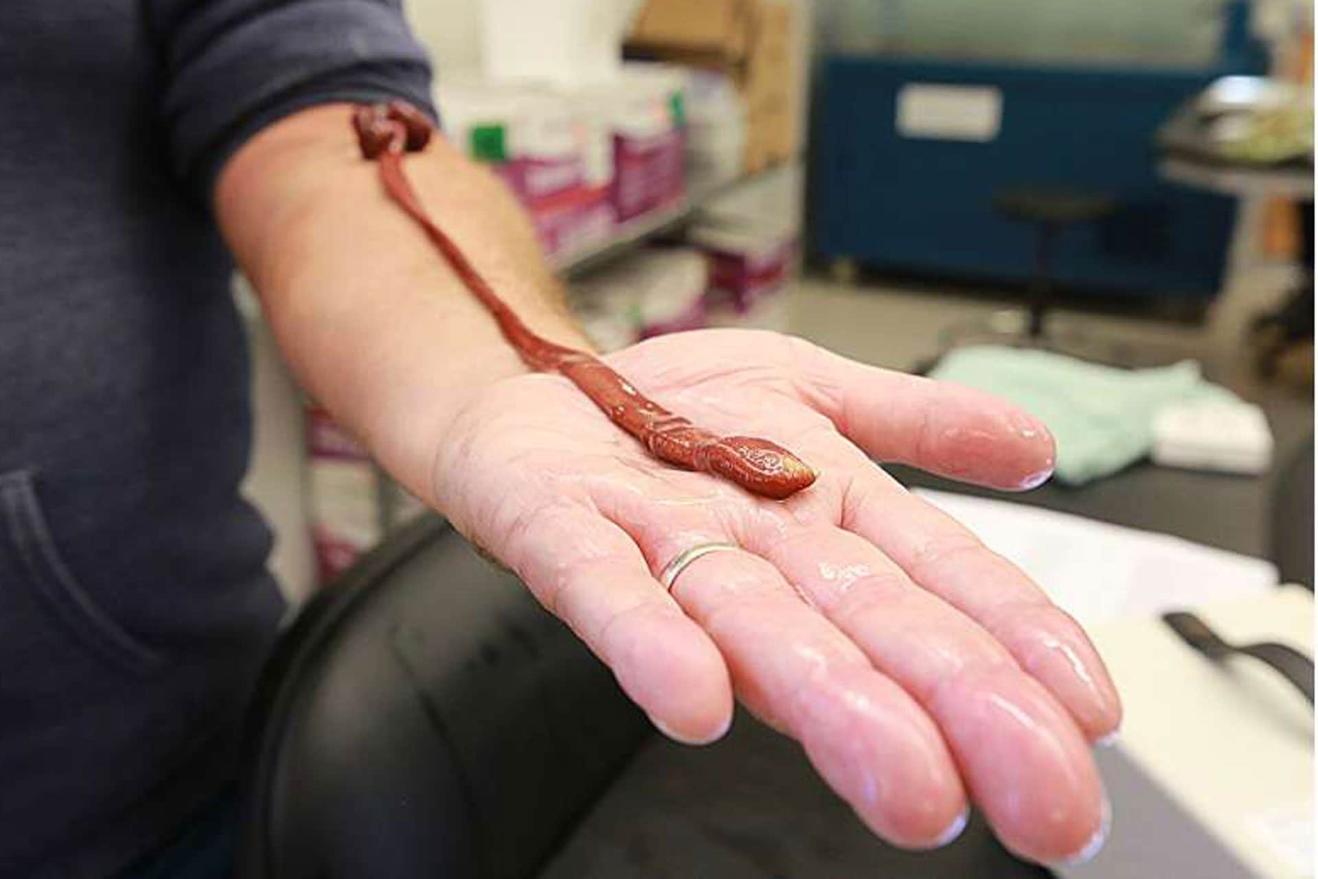 Baseodiscus the Eldest, il verme nastro più vecchio del mondo: la scoperta che sorprende gli scienziati