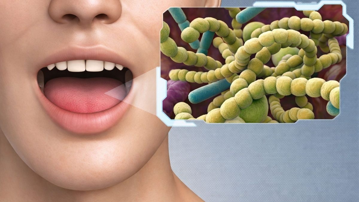 I batteri presenti nella bocca è al centro di uno studio che analizza il legame tra microbioma orale e obesità / iStock