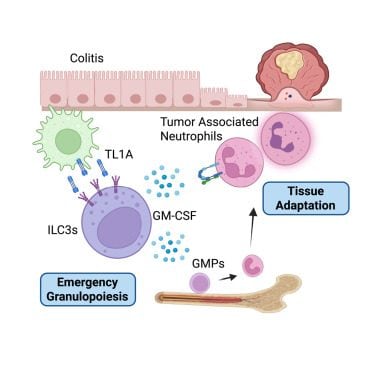 Il meccanismo immunitario individuato dallo studio: nell’intestino infiammato, la proteina TL1A attiva specifiche cellule immunitarie (ILC3), stimolando la produzione di neutrofili nel midollo osseo. Queste cellule, una volta richiamate nel colon, contribuiscono a creare un ambiente favorevole allo sviluppo del tumore / Credit: Pires S. et al., Immunity 2026