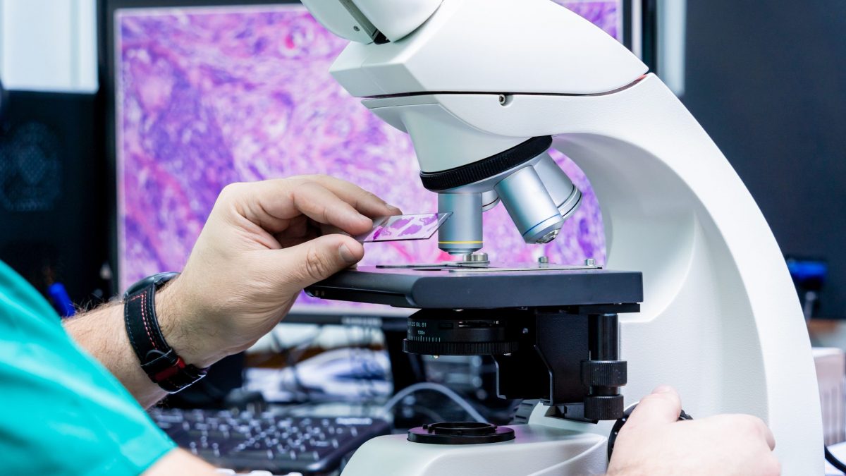 Un meccanismo immunitario, attivato dall’infiammazione cronica dell’intestino, può contribuire allo sviluppo del cancro del colon–retto / Photo: iStock