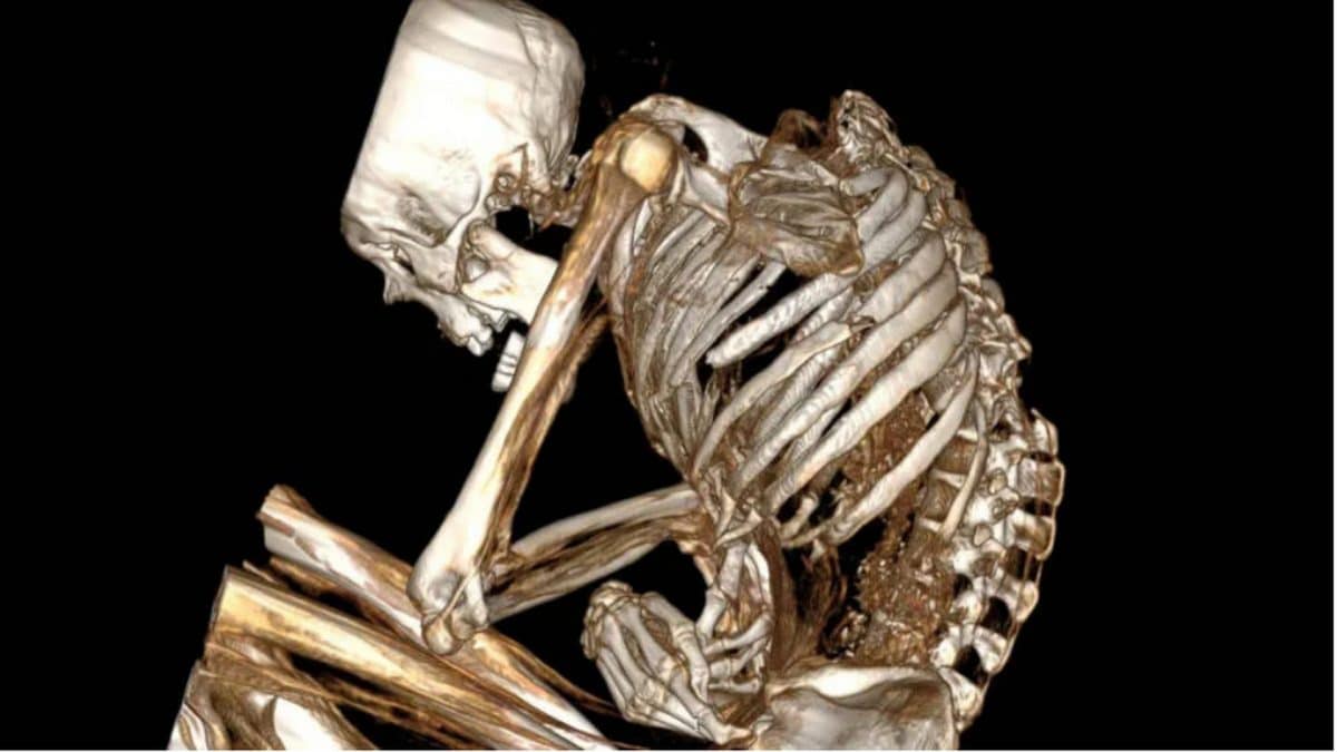 La scansioni della mummia dell’uomo. Credit: Catalina Morales / Francisco Garrido / International Journal of Osteoarchaeology