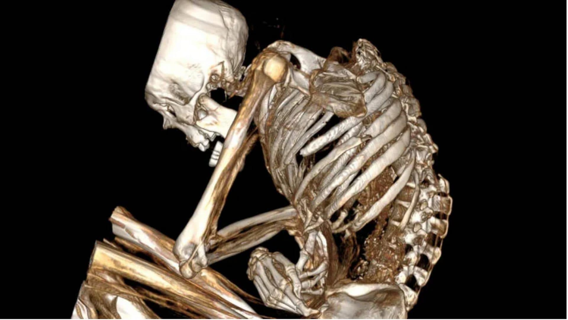 La TAC su una mummia di 1.100 anni rivela l'atroce causa della morte