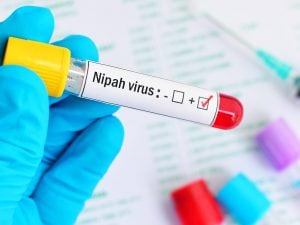 nipah-virus-300x225.jpg