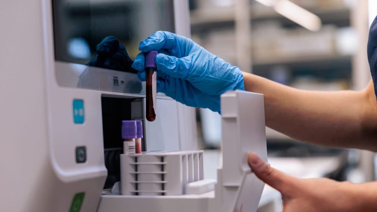 Alcuni segnali biologici del Parkinson sono rilevabili nel sangue solo in una fase preclinica, prima della comparsa dei sintomi motori, come mostra un nuovo studio pubblicato su npj Parkinson’s Disease / Photo: iStock