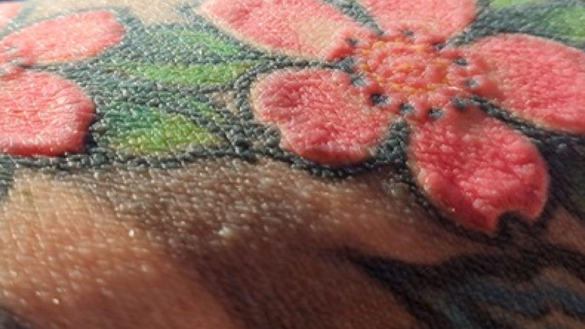 Un dettaglio del tatuaggio con inchiostro rosso / Credit: Mateuszczyk et al., Clinics and Practice 2025.