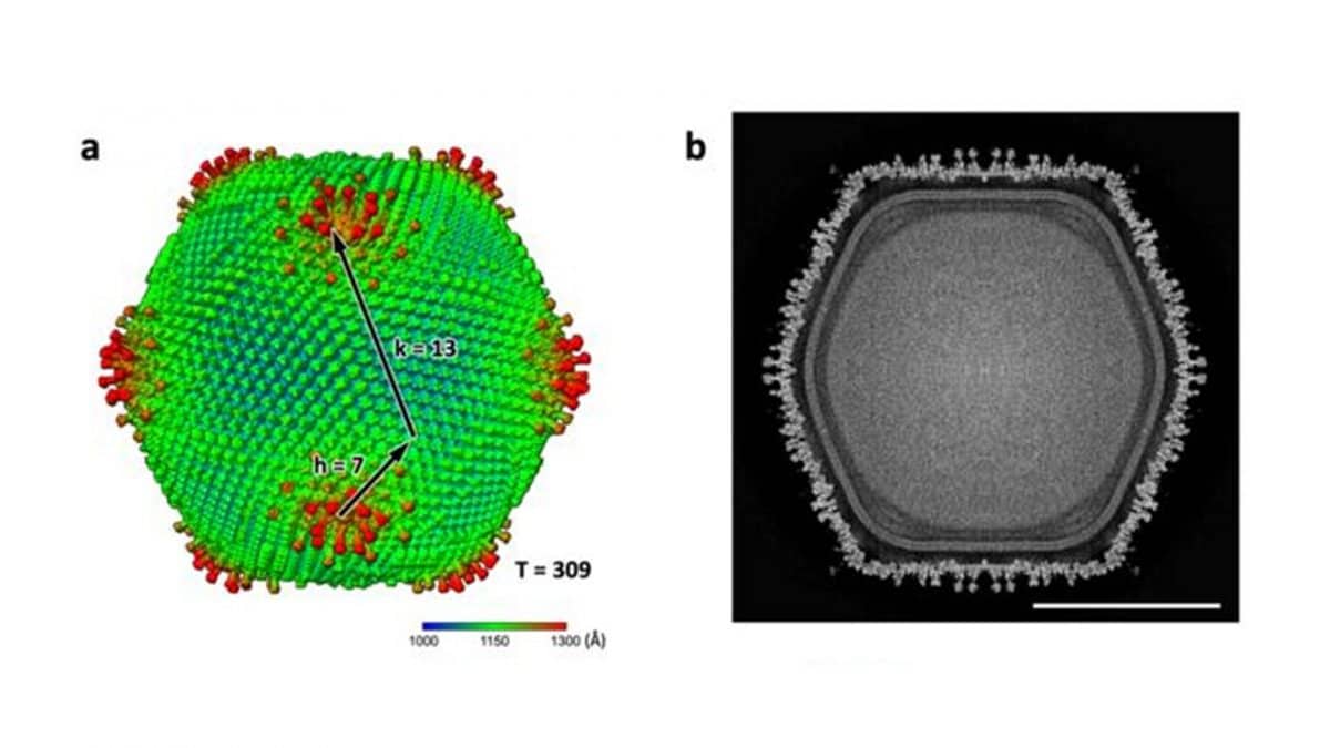 Il nuovo virus gigante giapponese Ushikuvirus. Credit: Professor Kazuyoshi Murata from the National Institute of Natural Sciences (NINS) Image source: https://journals.asm.org/doi/10.1128/jvi.01206–25
