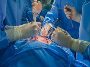 Cuore “carbonizzato” prima del trapianto a un bimbo a Napoli: perché il ghiaccio può bruciare un organo