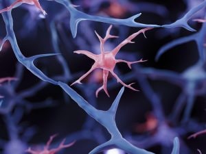 Alzheimer, scoperto un nuovo modo per rallentare la perdita di memoria e i sintomi iniziali