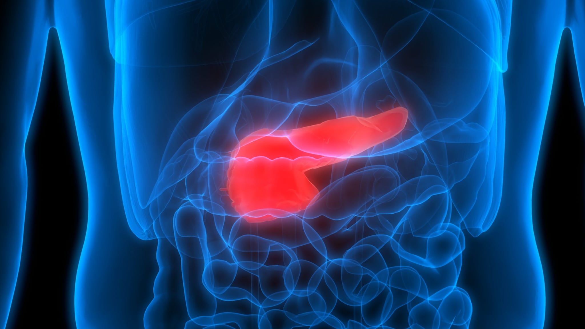 Tumore al pancreas eliminato nei topi: Roberto Burioni spiega perché la cura umana è ancora lontana