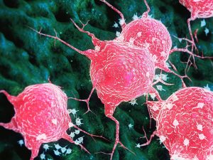 tumore-cellule-immunitarie-attacco-300x225.jpg