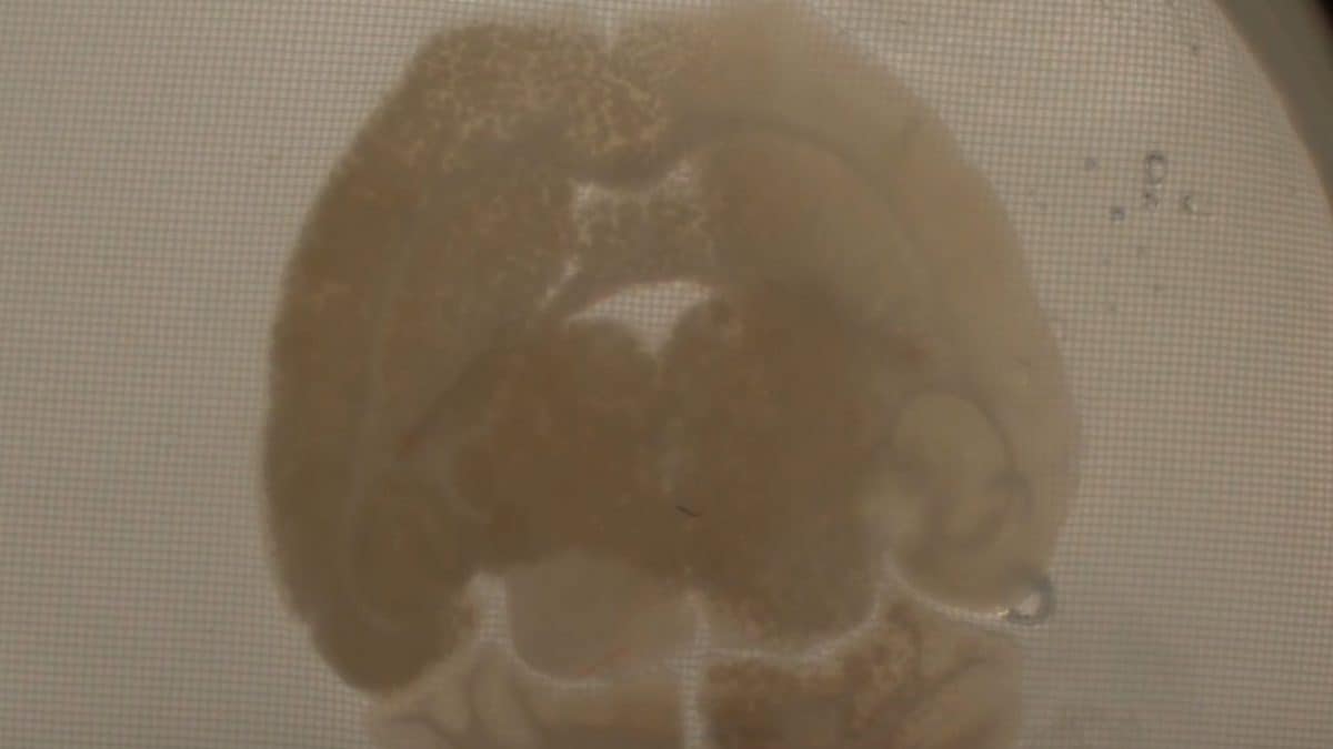 Una sezione di cervello di topo vetrificato e riattivato. Credit: Germa et al/PNASCE