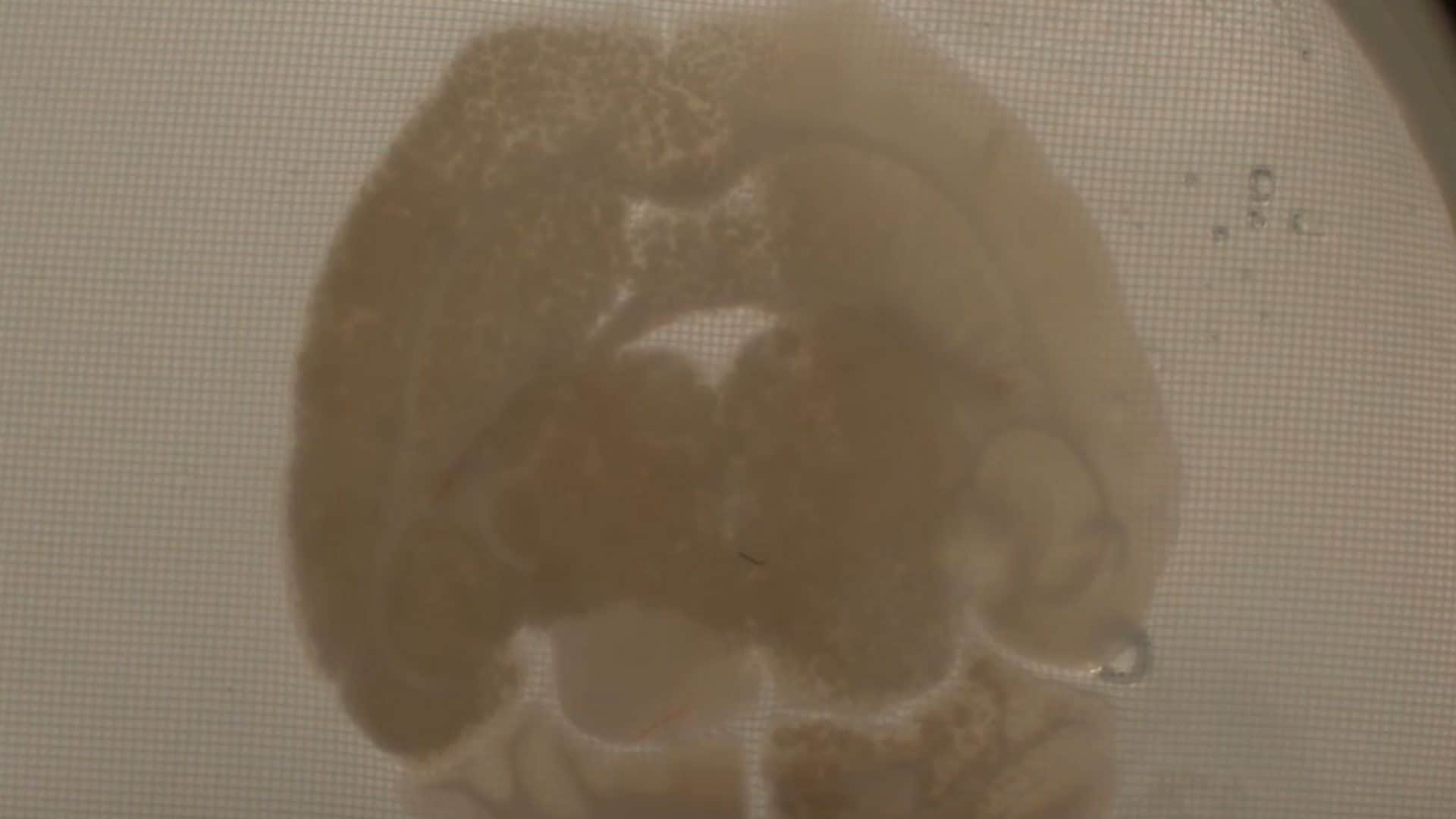 Tessuto cerebrale vetrificato torna “attivo” dopo lo scongelamento: risultato storico sul cervello