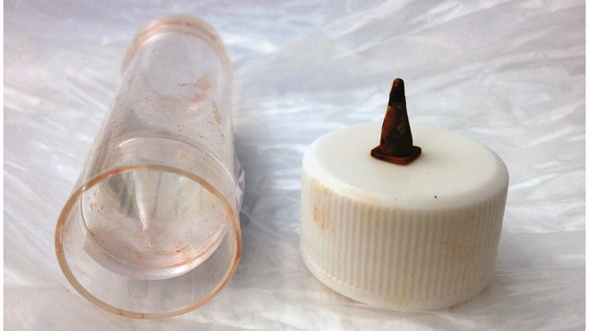 Ha tosse e infezioni da anni: medici estraggono un cono stradale giocattolo inalato 40 anni prima