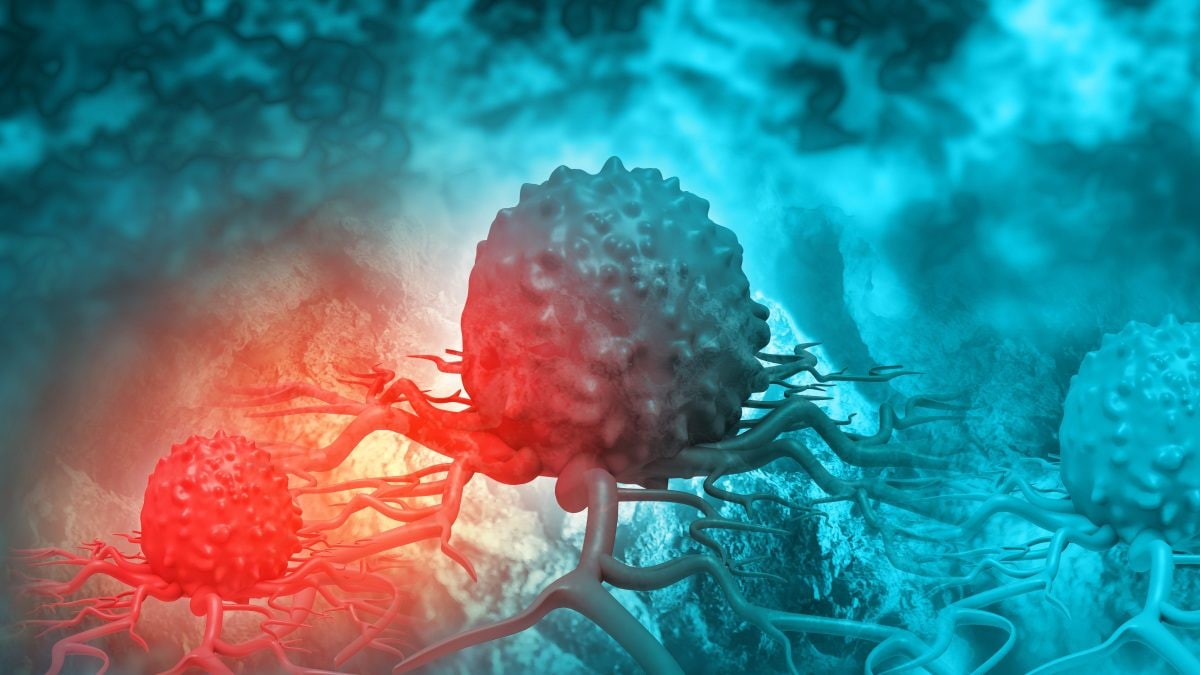 La molecola vegetale DHL–11 ha mostrato nei test preclinici la capacità di indurre l’autodistruzione delle cellule del tumore al seno triplo negativo.
