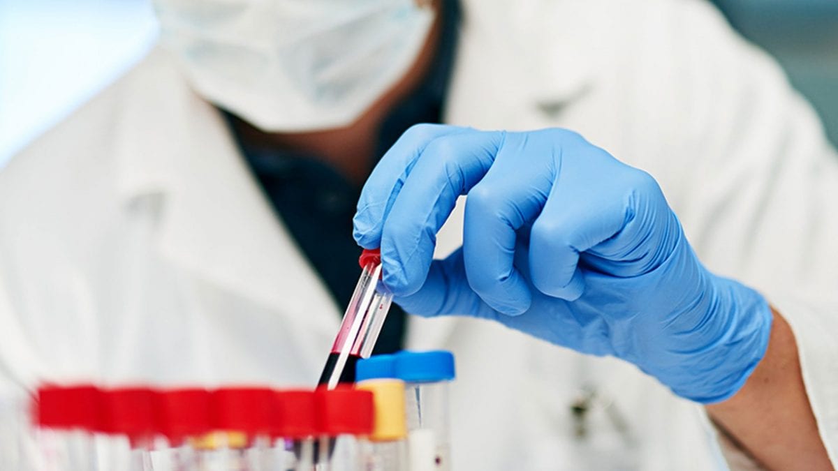 Lo studio SWISS100 ha identificato 37 proteine nei centenari associate a un invecchiamento più lento.