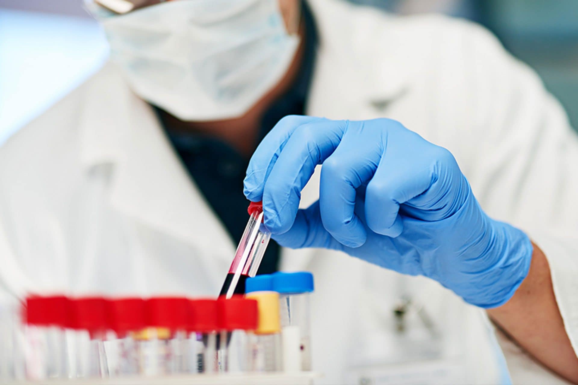 Nel sangue dei centenari scoperte 37 proteine legate a un invecchiamento più lento