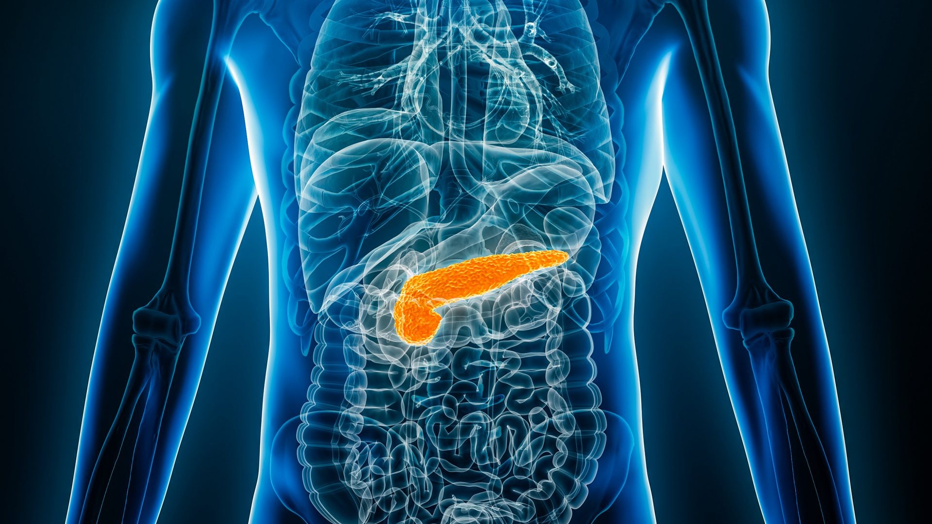 "Il tumore al pancreas è raro e diverso dagli altri": l'oncologo Reni spiega perché è difficile da curare