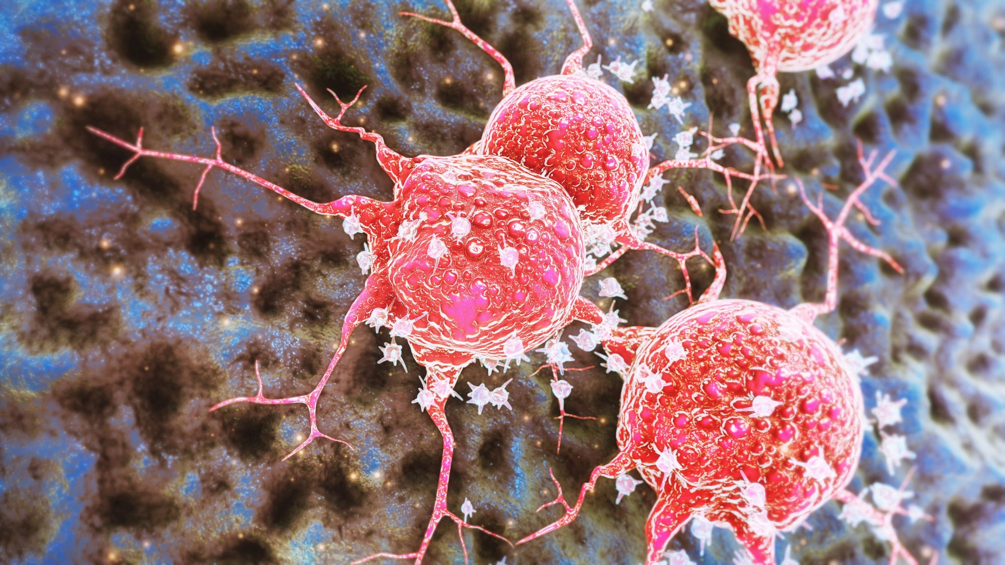 Tumori più frequenti in Italia nel 2025: seno, polmone, colon-retto e prostata tra i più diagnosticati