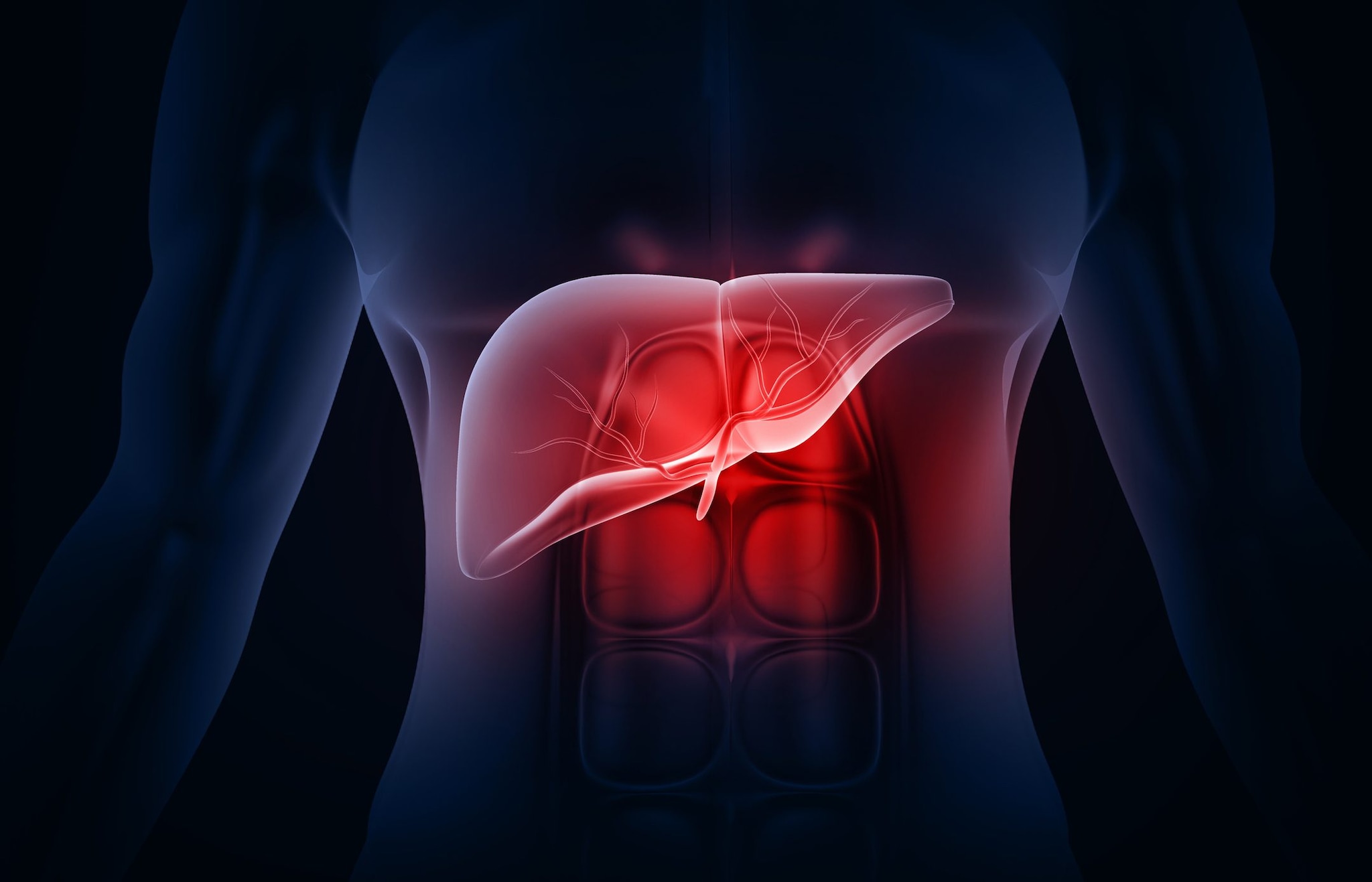 Fegato grasso, nuovo studio su The Lancet: fino a 1,8 miliardi di casi nel mondo entro il 2050