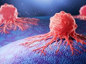 Studio USA svela perché alcuni tumori sono più aggressivi di altri: il ruolo delle dimensioni cellulari