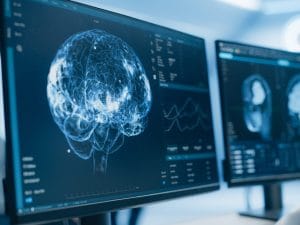 Primi segnali di Alzheimer già dai 45 anni: i risultati dello studio Dunedin su pTau181