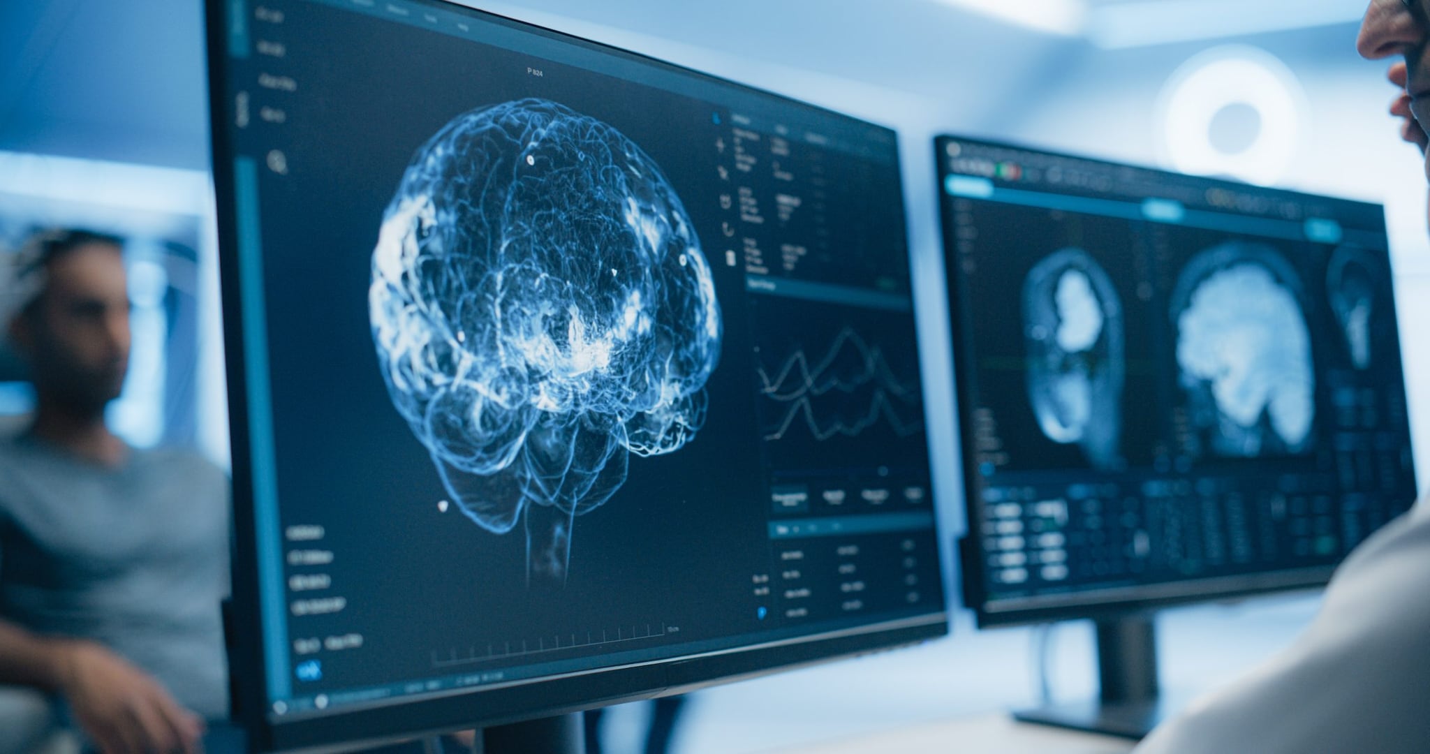 Primi segnali di Alzheimer già dai 45 anni: i risultati dello studio Dunedin su pTau181