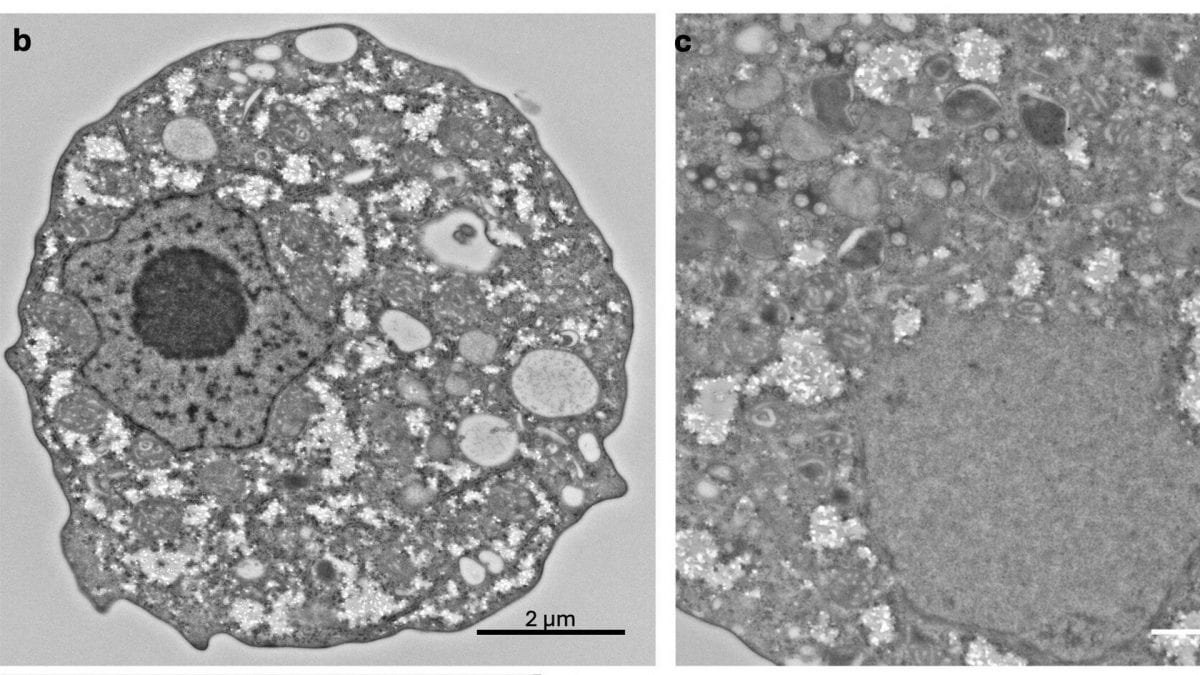 Il furtivovirus visto al microscopio elettronico. Credit: Bae e Takemura/ Journal of Virology