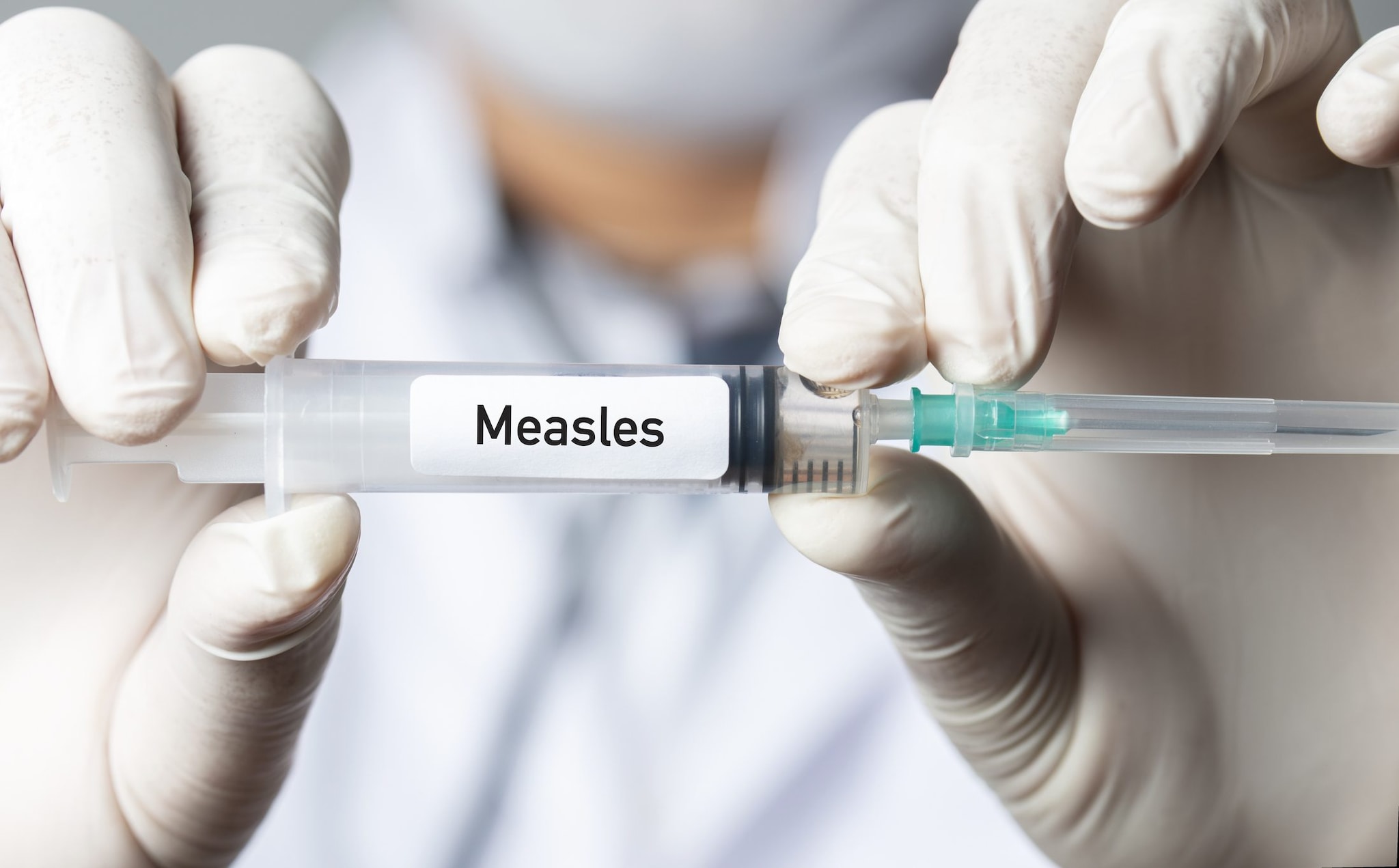 Nel 2026 triplicati i casi di morbillo in Italia, gli assistenti sanitari: "Rischio complicanze negli adulti"