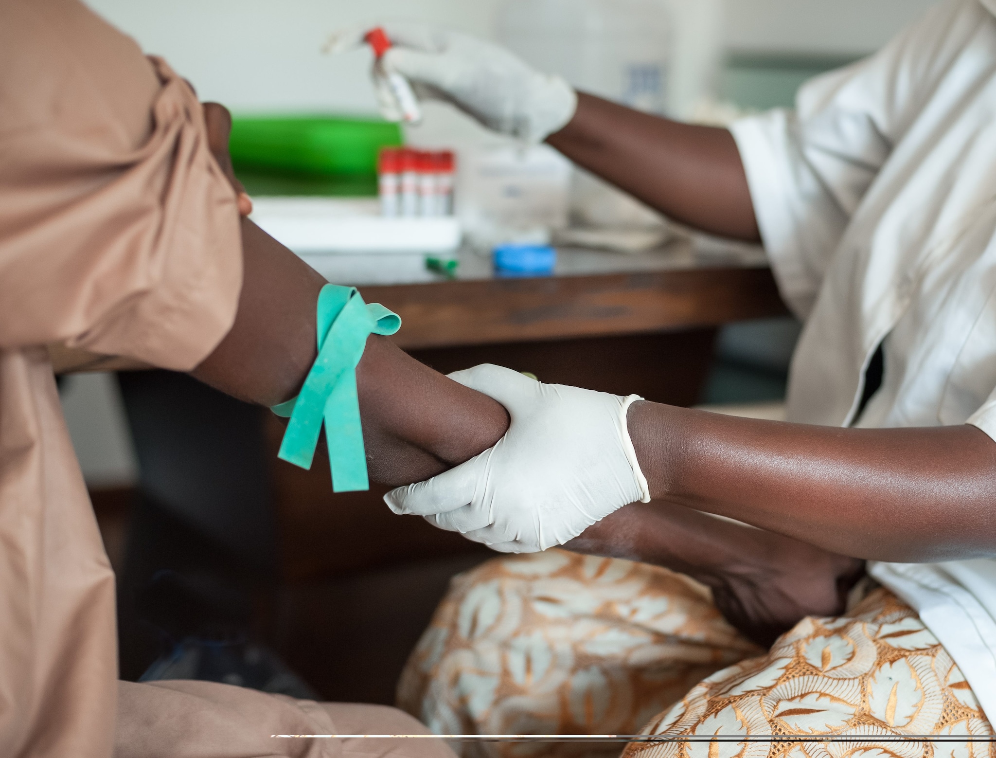 Ebola Bundibugyo, l’Oms annuncia il primo paziente guarito: per il virus non esistono cure specifiche