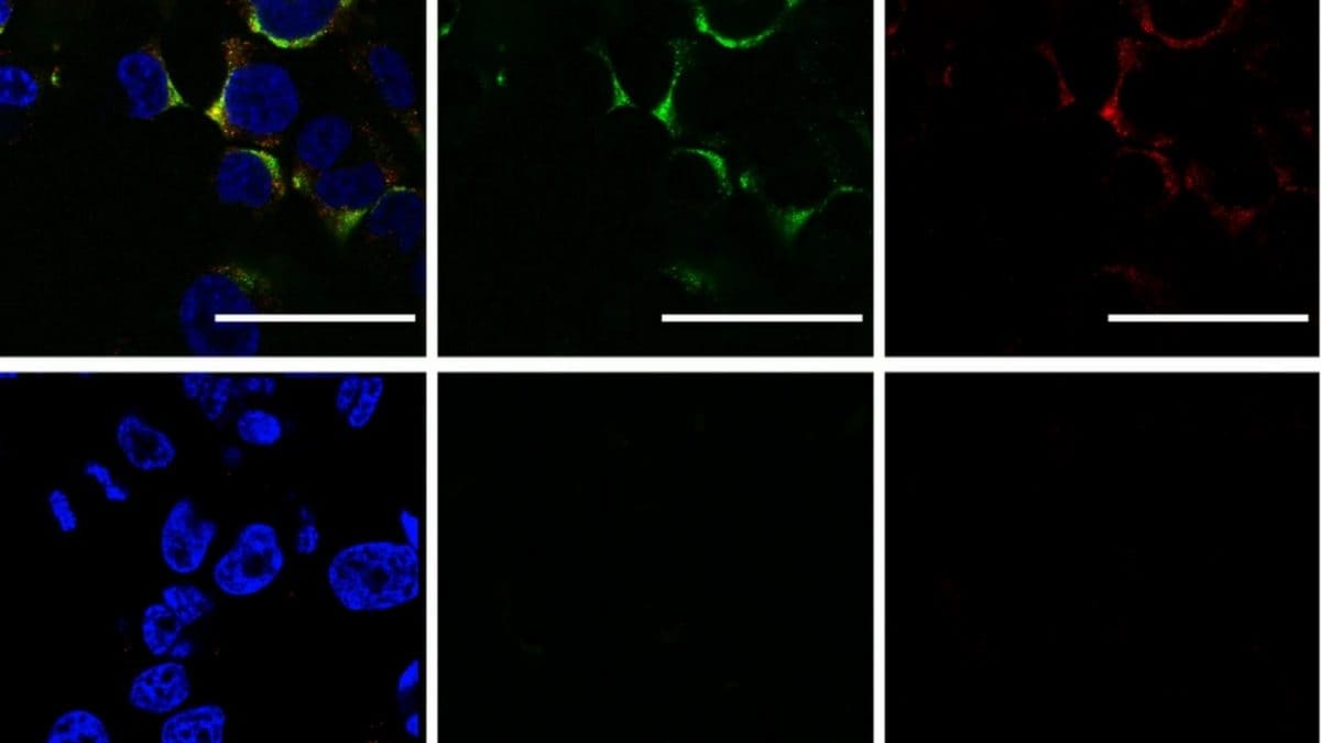 Virus distrutti dopo il bombardamento con le onde sonore. Credit: Scientific Reports/Università di San Paolo
