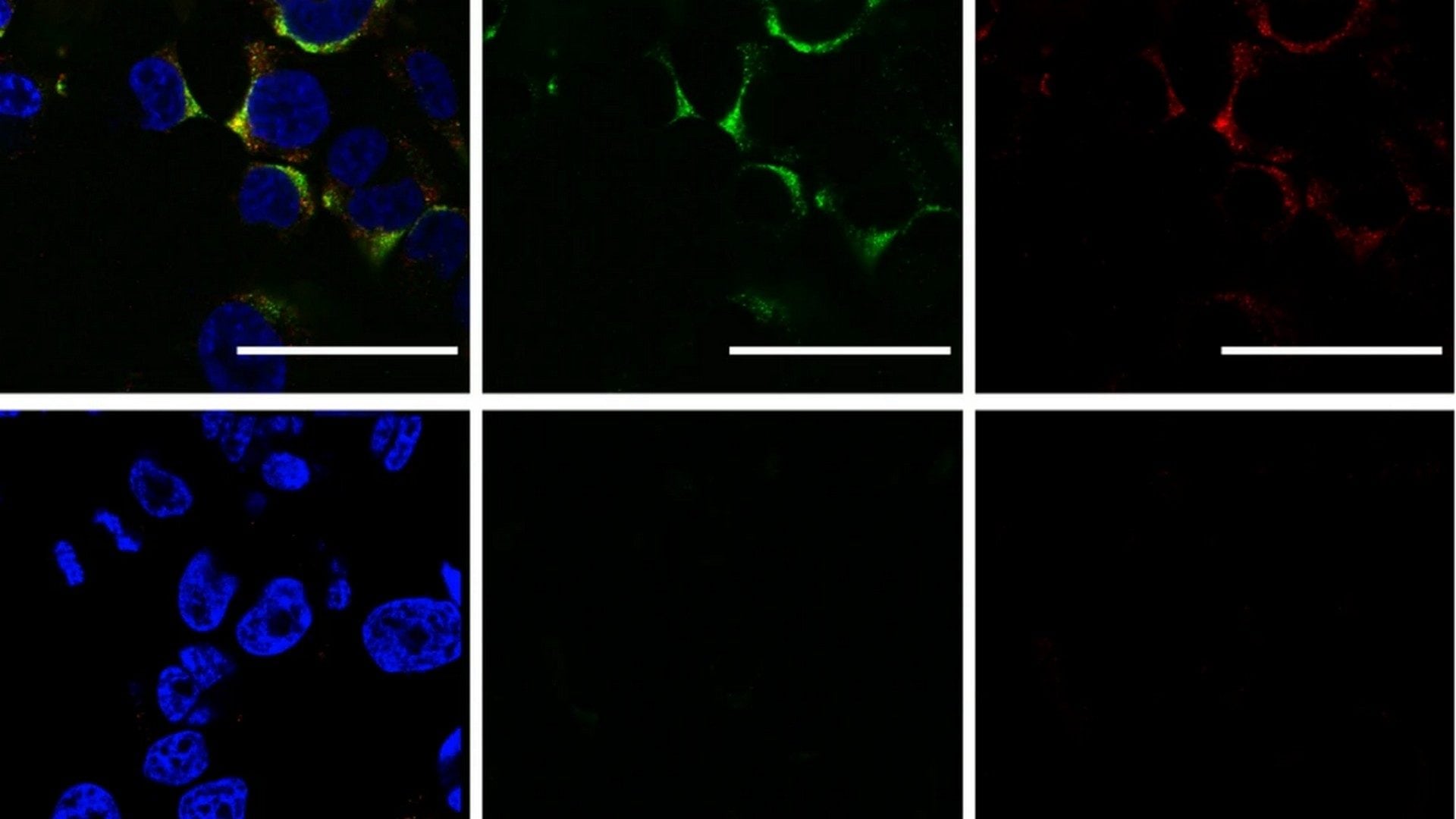 Scienziati distruggono i virus di Covid e influenza con le onde sonore: la nuova "arma" contro i patogeni