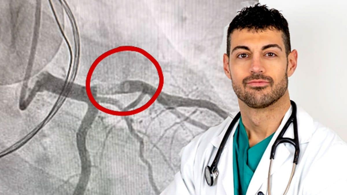 Il cardiologo José Abellán e l’immagine dell’arteria coronaria del giovane di 27 anni colpito da infarto