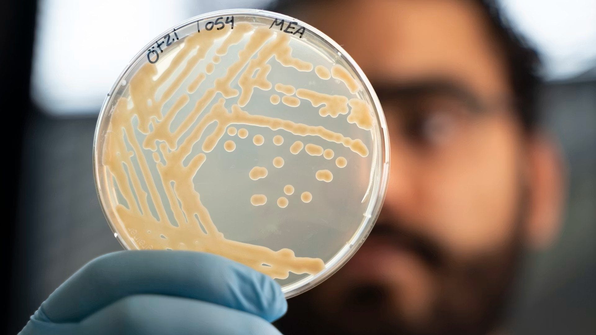 Un lievito isolato dallo stomaco di Ötzi tenuto in mano dal microbiologo Mohamed Sarhan. Credits: Eurac Research/Andrea De Giovanni