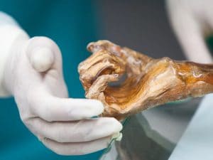 Scoperta di lieviti antichi sulla mummia di Ötzi