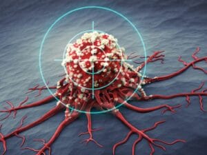 Scoperte mediche sul trattamento del tumore alla vescica
