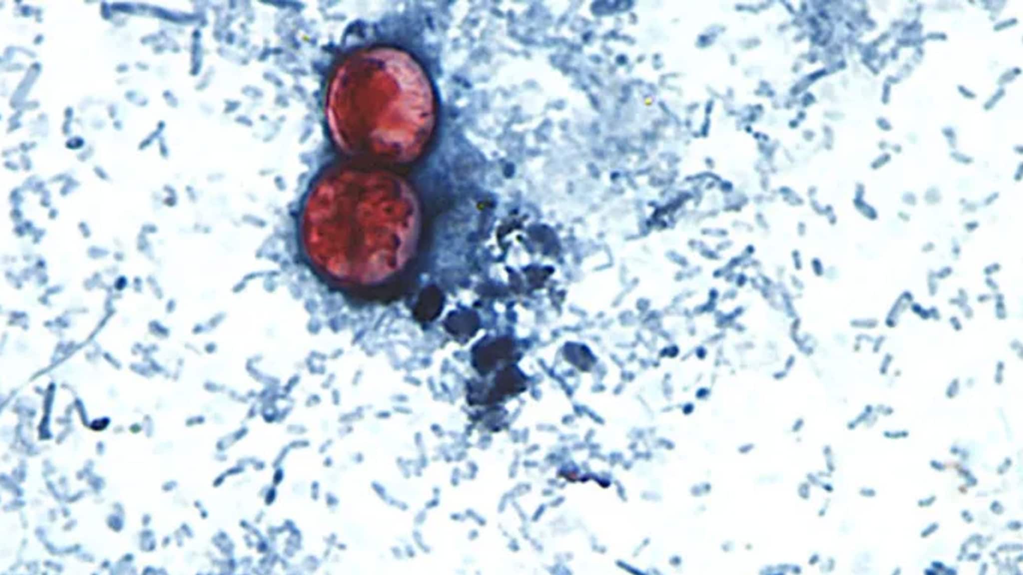 Epidemia di ciclosporiasi negli USA, come si sarebbe diffusa a oltre 3.000 persone: l’ipotesi di frutta e verdura