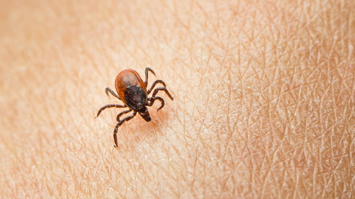 Zecca sulla pelle. Credit: iStock
