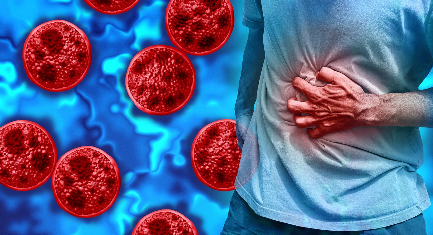 Epidemia di ciclosporiasi negli Stati Uniti: cos’è, sintomi e come si trasmette l’infezione intestinale