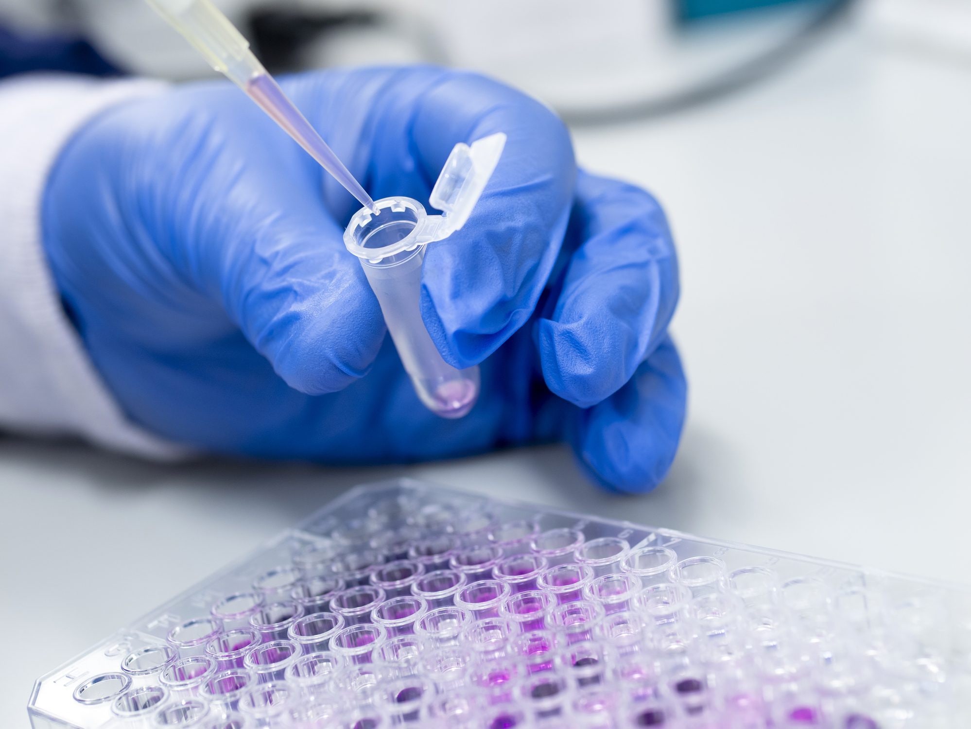 Anthropic ha scoperto nei virus mangiabatteri un meccanismo genetico mai visto prima
