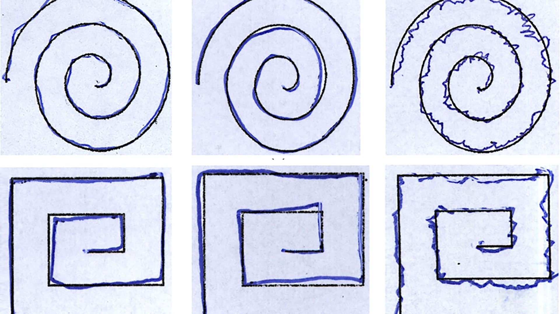 Un segnale di Parkinson si può notare nei disegni: le irregolarità da osservare