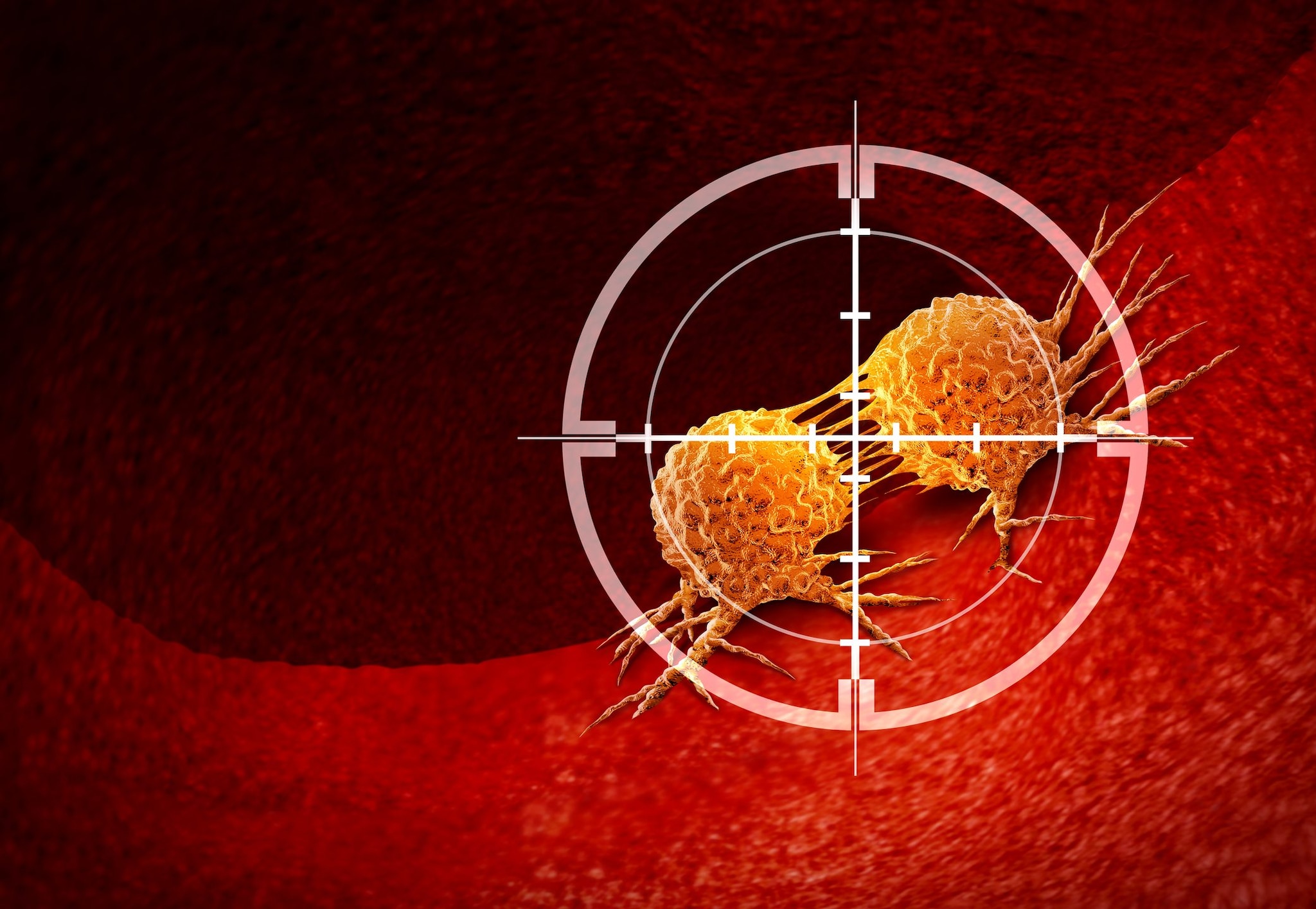 Un tumore su otto è causato da virus e batteri: quali sono i 5 principali responsabili e come difendersi