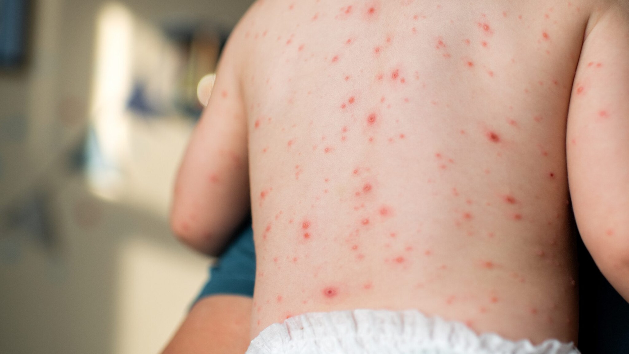 Mia figlia è allergica agli abbracci