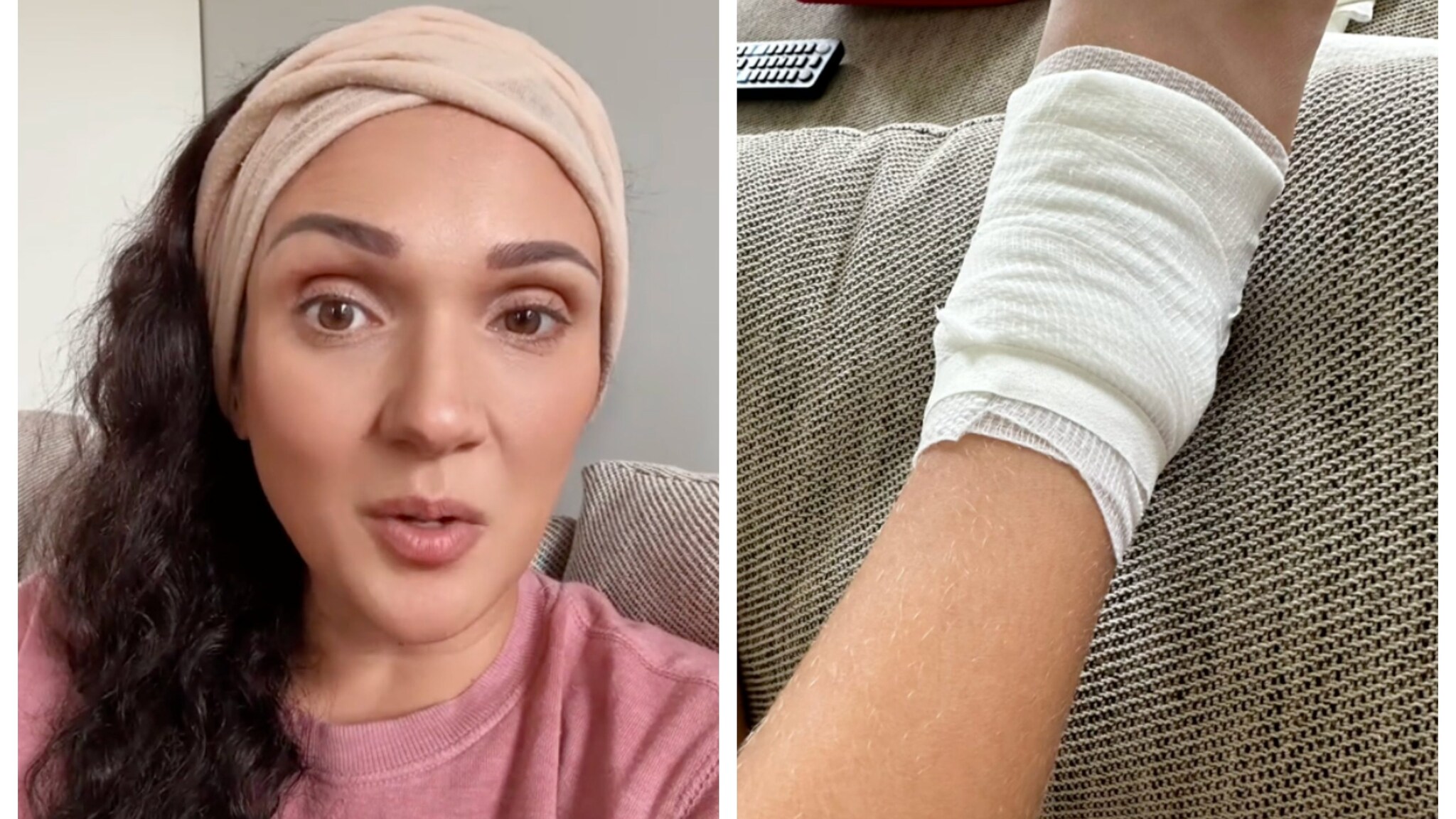 Attenzione alla colla per la unghie finte, l'allarme di una mamma: "Ha ustionato la pelle di mia figlia"